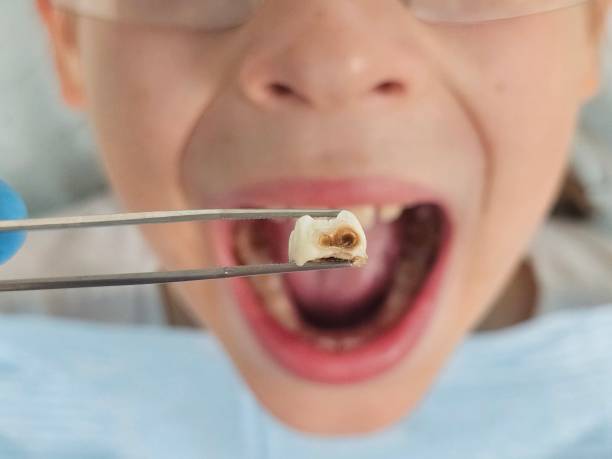 Best Emergency Dental Services for Seniors in Depoe Bay, OR